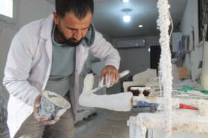 Preparing orthodontic splints