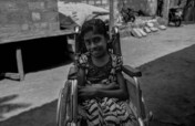 Hope for Differently Abled - Northern Sri Lanka