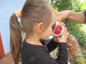 Children with TB