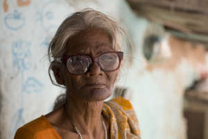 Malnourished Patient