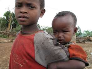 A young child with early signs of trachoma