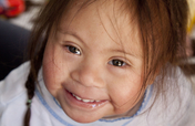 Disability Aid in Rural Peru