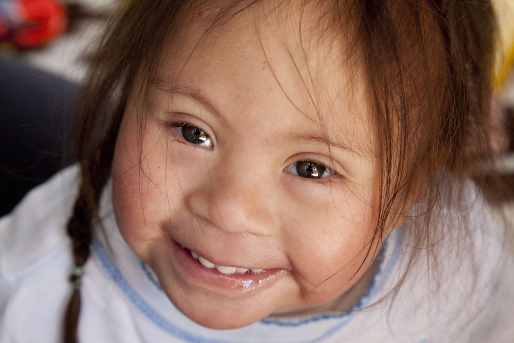 Disability Aid in Rural Peru