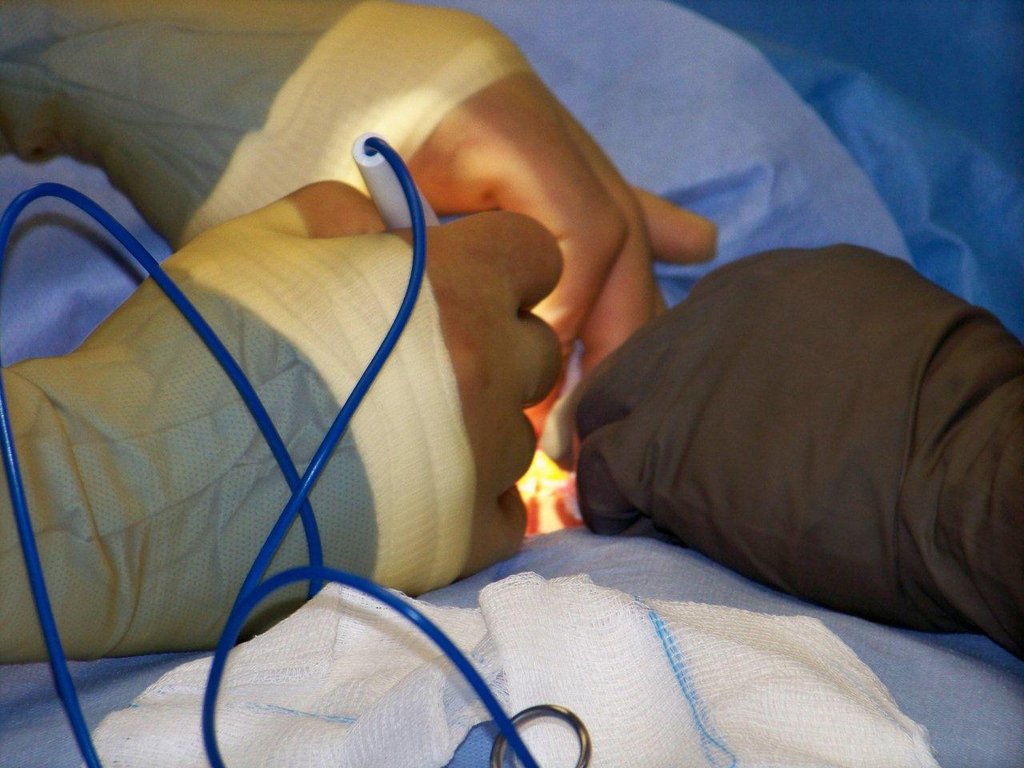 Provide thyroid surgery for 20 Ecuadorians