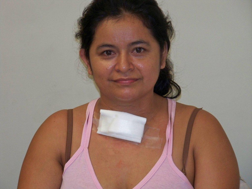 Provide thyroid surgery for 20 Ecuadorians