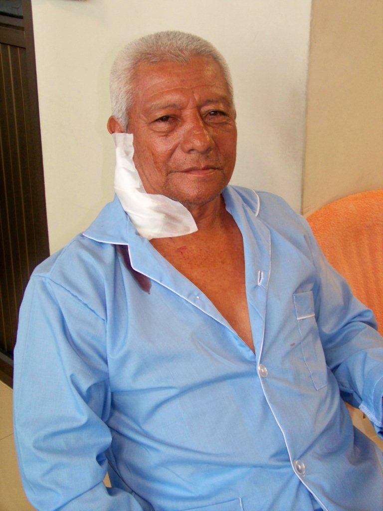 Provide thyroid surgery for 20 Ecuadorians