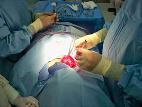 Thyroid surgery: Ecuador