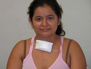 After successful thyroid surgery: Ecuador