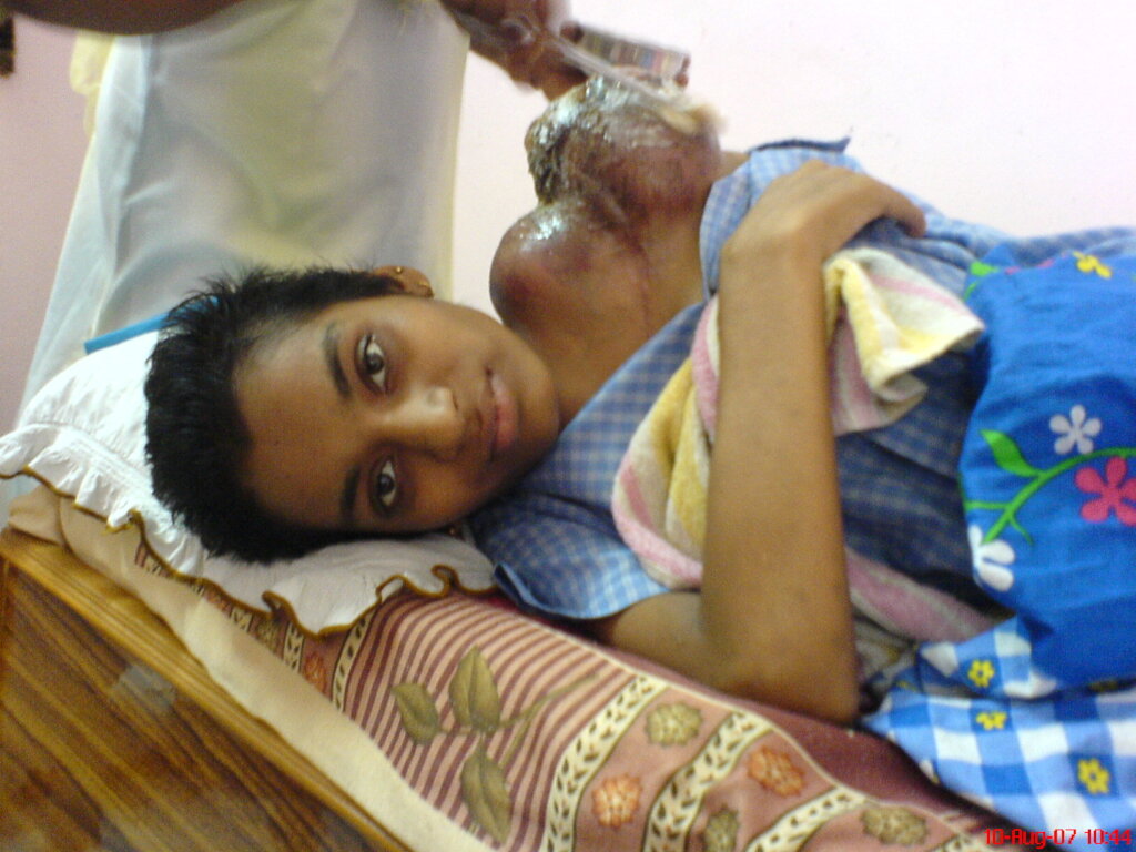 Empower 2,000 women in India battling cancer
