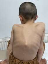 Picture Before the Treatment