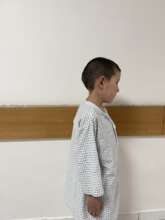 Picture After the Treatment