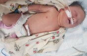 Help Margarita Stand on Her Feet!