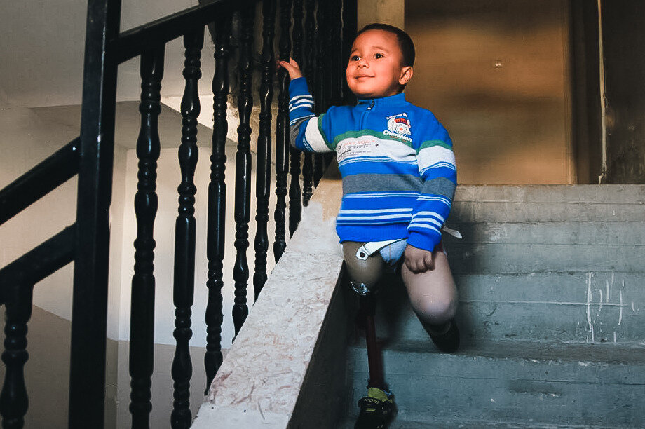 Support poor  People with Prosthetic Device