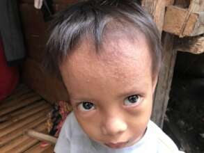 Skin Condition of Bajau Children