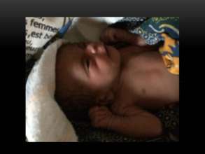 Premature baby--Mom had malaria