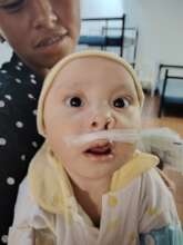 Diego After Surgery