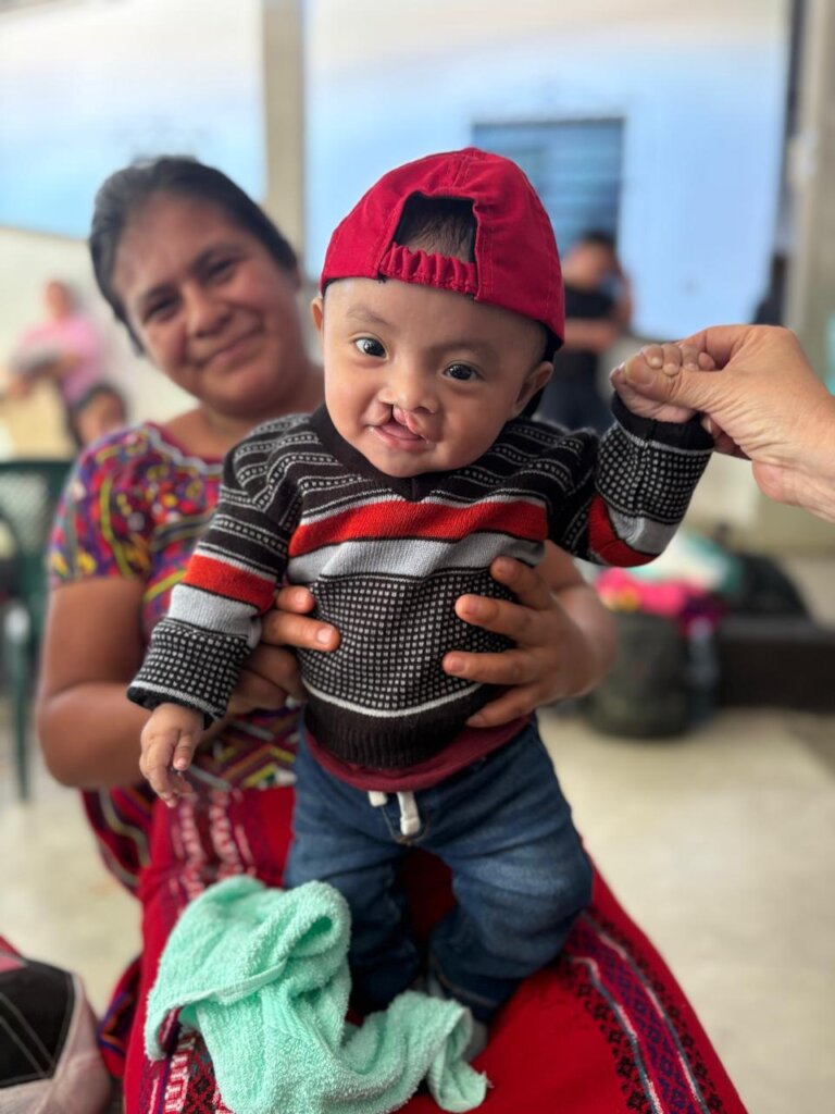 Support Cleft Nutrition in Rural Guatemala