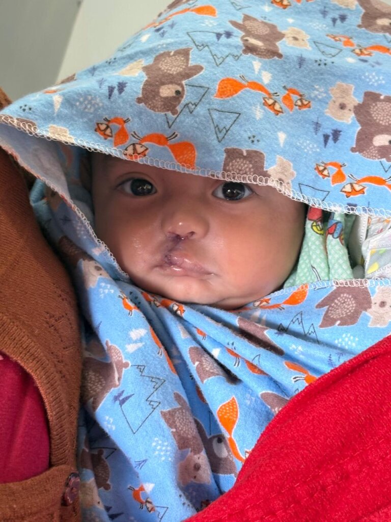Support Cleft Nutrition in Rural Guatemala