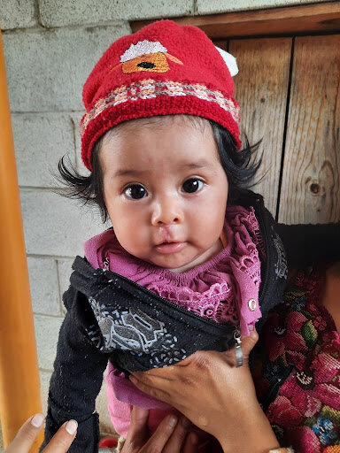 Support Cleft Nutrition in Rural Guatemala