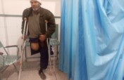 Prosthetic Limbs for 50 Impoverished Individuals