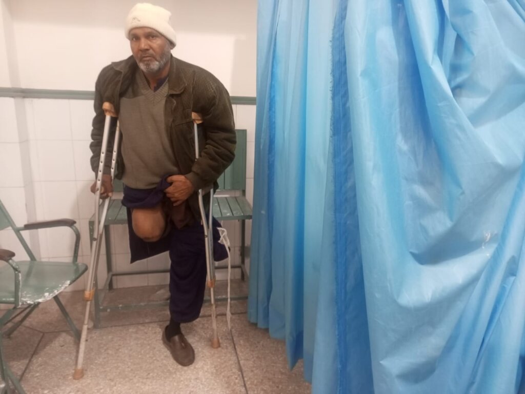 Prosthetic Limbs for 50 Impoverished Individuals
