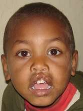 Kemal before surgery