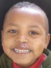 Kemal after surgery