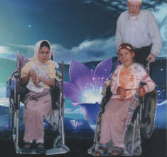 Twin sisters with birth-induced brain damage