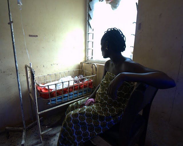 Treating Babies with Severe Jaundice in India