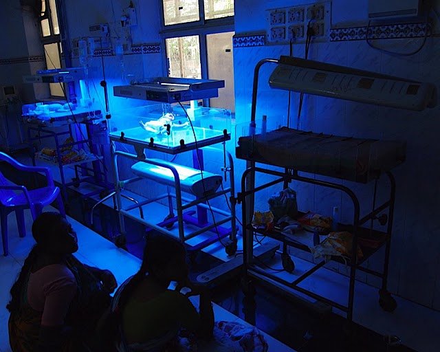 Treating Babies with Severe Jaundice in India