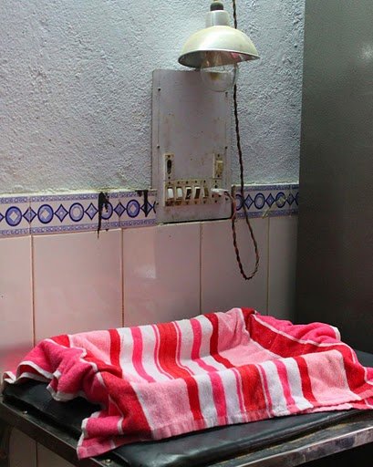 Treating Babies with Severe Jaundice in India