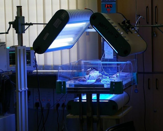Treating Babies with Severe Jaundice in India