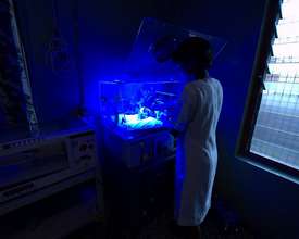 Treating Babies with Severe Jaundice in India