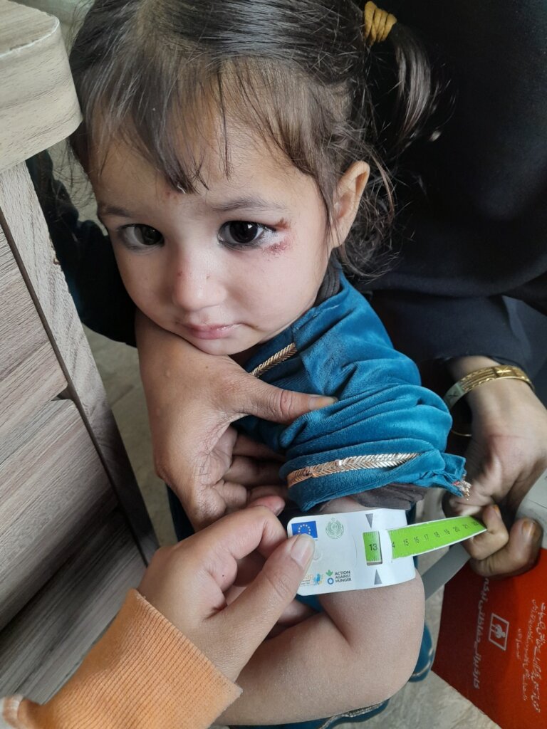 Save 1000 children from Malnutrition in rural Sind