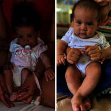 Evolucion 2 meses de tratamiento nutricional