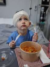A few hours after the cochlear implant operation