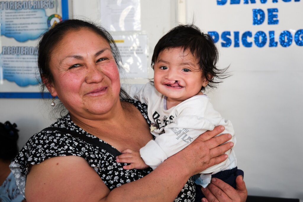 Help 40 more children receive surgery in Peru