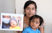 Help 40 more children receive surgery in Peru