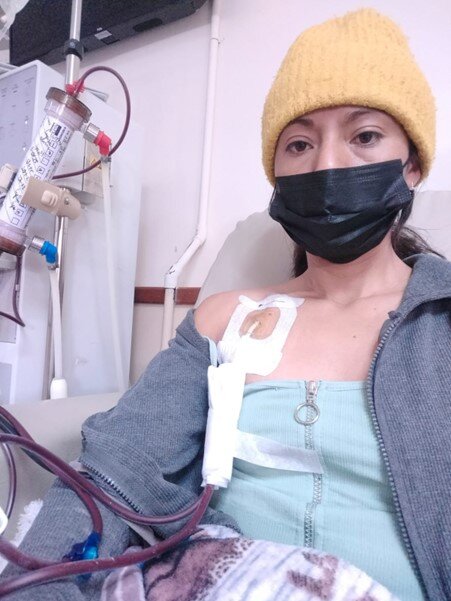 Hemodialysis for 75 Kindey Patients in Mexico