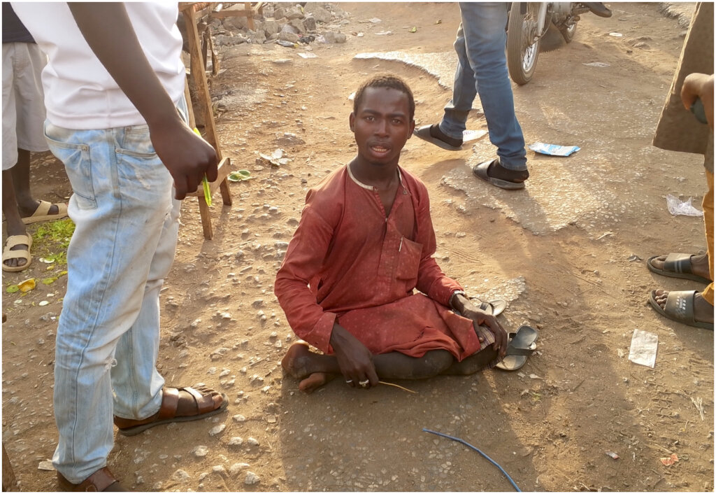 Provide Medical Help for Disabled People with HIV+