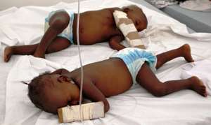 Cholera epidemic in July