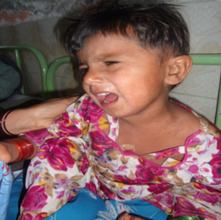 Child admitted  with measles and body rash