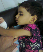 Child admitted with malaria  - Shikarpur