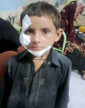Child admitted with Injuries- Shikarpur