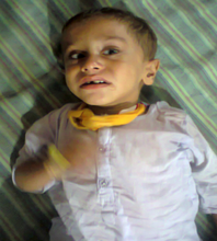 Child admitted with malaria and fits- Shikarpur