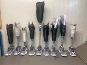 Help Disabled Congolese Walk with 3D Limbs