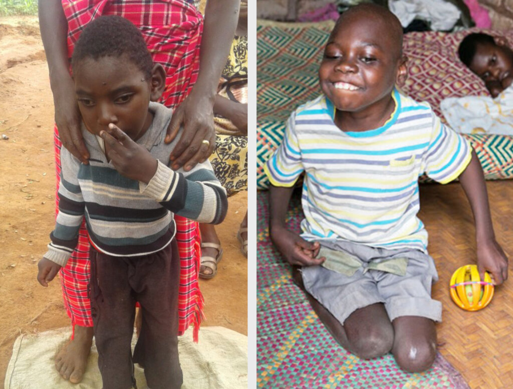 Support 300 Children with Cerebral Palsy in Kano