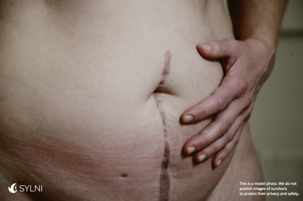 Support Survivors of Sexual Violence in Ukraine