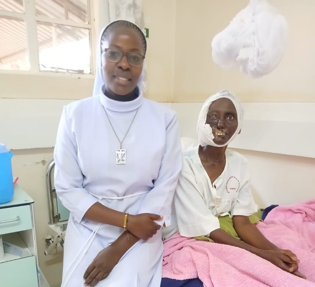 MEDICAL SUPPORT FOR A ADENOID CYSTS CARCINOMA MOM