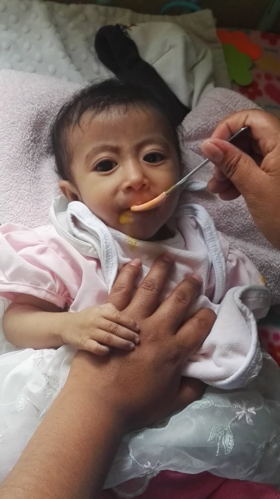 Rescue a Malnourished Child in Guatemala